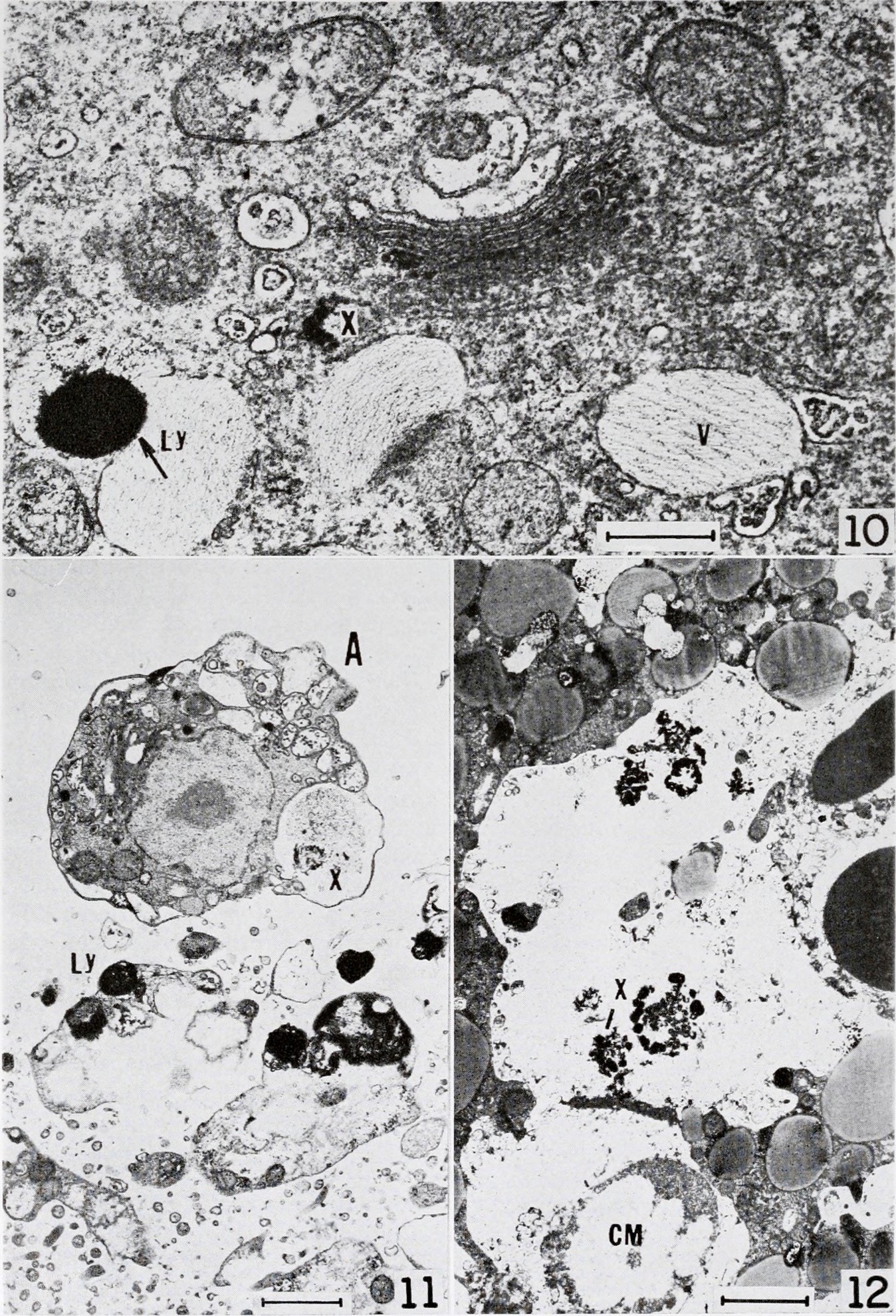 lisosomas al microscopio 